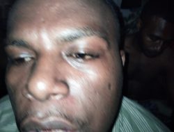 Mahasiswa Tahanan Politik Pengibar Bintang Kejora Babak Belur Dianiaya Petugas Lapas Abepura, Papua