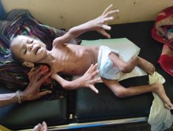 Kondisi Bayi Kurang Gizi di Kabupaten Yahukimo Sangat Memprihatinkan